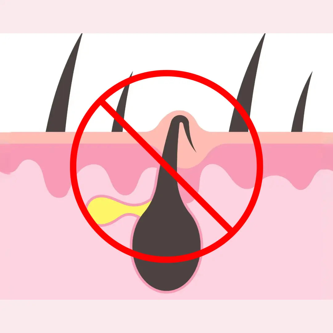 4. Menos Pelos Encravados