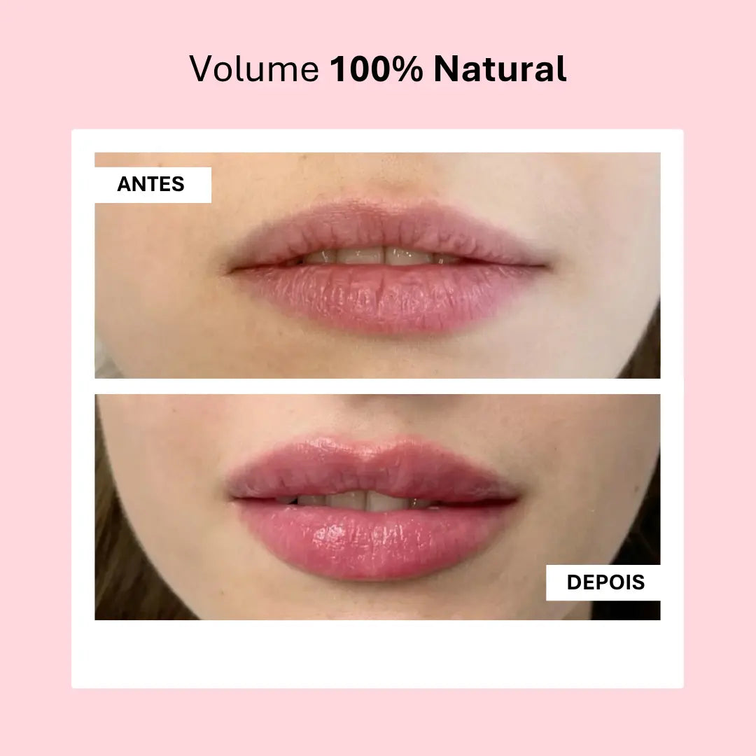 Lip Booster KIT | Lábios Volumosos Naturalmente