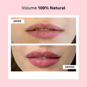 Lip Booster KIT | Lábios Volumosos Naturalmente