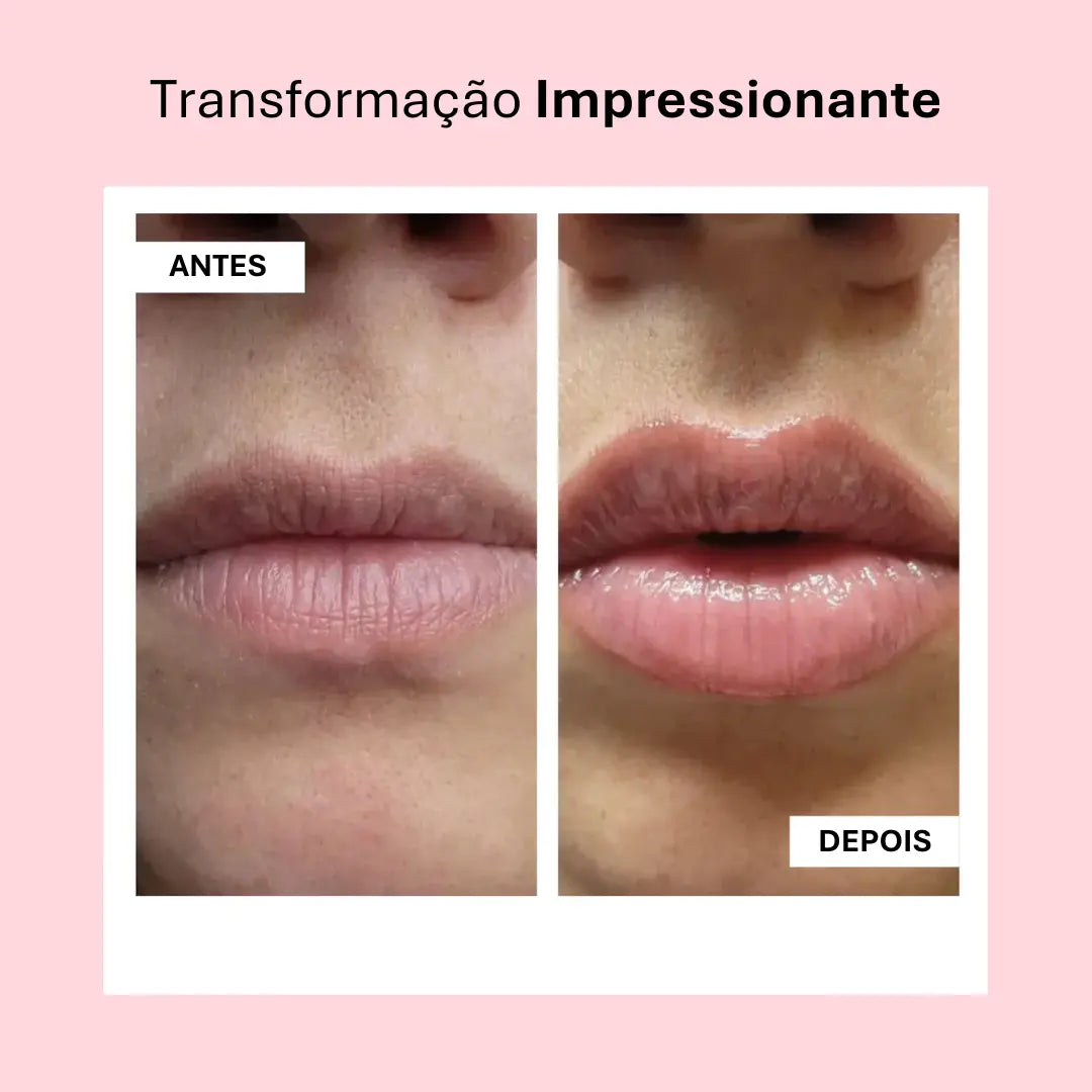 Lip Booster KIT | Lábios Volumosos Naturalmente