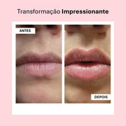 Lip Booster KIT | Lábios Volumosos Naturalmente
